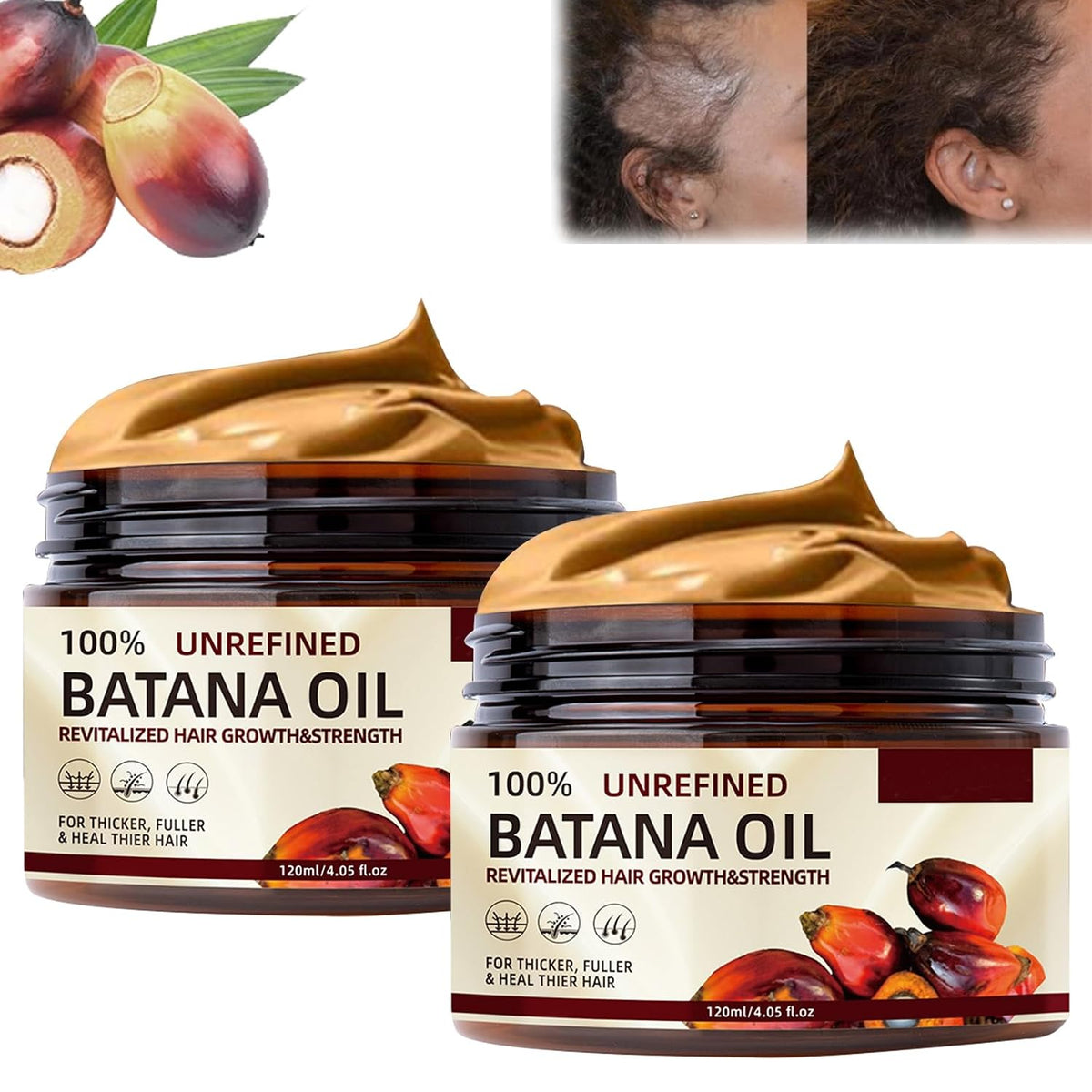 Batana Oil for Hair Growth, Batana Oil from Honduras, 100 Percent Pure Batana Oil, Batana Oil Organic Raw, Batana Miracle Hair Loss Oil, Repairs Damaged Hair, Leaves Hair Smoother 120g
