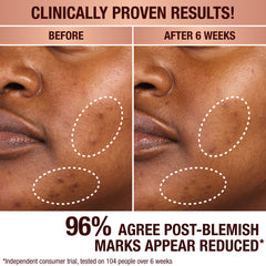 DARK SPOT SERUM & CHARLOTTE’S MAGIC CREAM DUO
